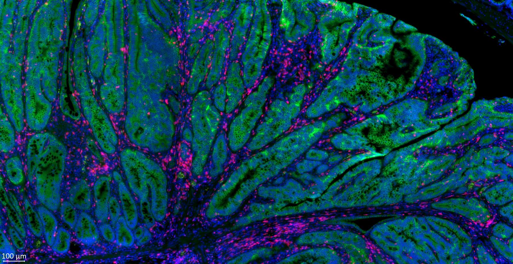 Immunofluorescence imaging of Mouse Colon Tumor
